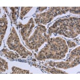 Immunohistochemistry - IPO8 Antibody from Signalway Antibody (37659) - Antibodies.com