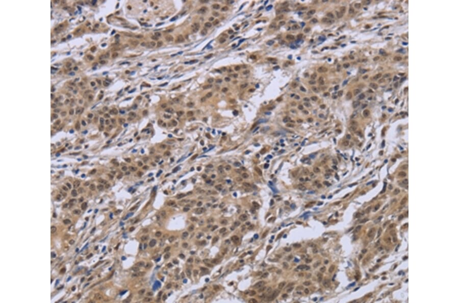Immunohistochemistry - IPO8 Antibody from Signalway Antibody (37659) - Antibodies.com