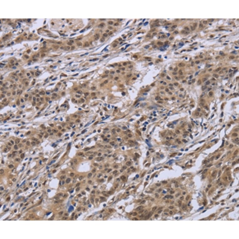 Immunohistochemistry - IPO8 Antibody from Signalway Antibody (37659) - Antibodies.com