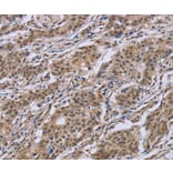 Immunohistochemistry - IPO8 Antibody from Signalway Antibody (37659) - Antibodies.com