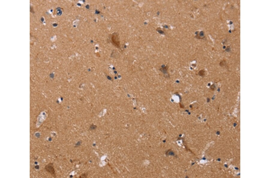 Immunohistochemistry - JAG1 Antibody from Signalway Antibody (37668) - Antibodies.com