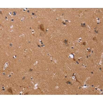 Immunohistochemistry - JAG1 Antibody from Signalway Antibody (37668) - Antibodies.com