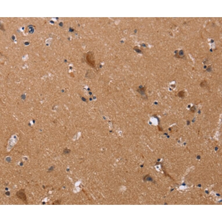 Immunohistochemistry - JAG1 Antibody from Signalway Antibody (37668) - Antibodies.com