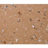 Immunohistochemistry - JAG1 Antibody from Signalway Antibody (37668) - Antibodies.com