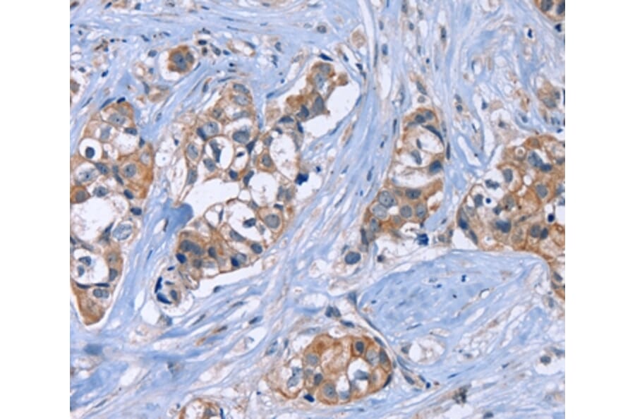 Immunohistochemistry - JAG1 Antibody from Signalway Antibody (37668) - Antibodies.com