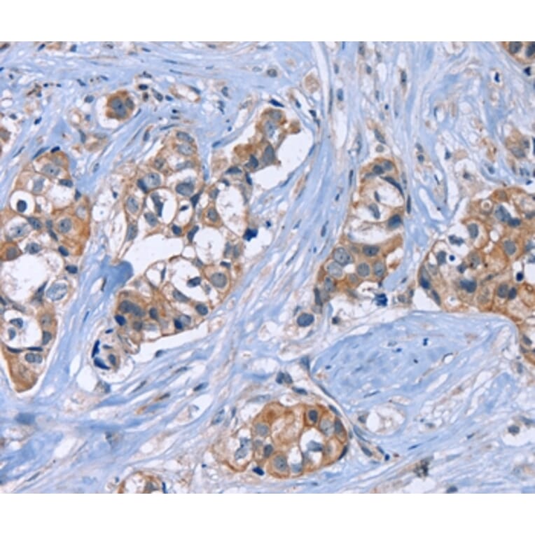Immunohistochemistry - JAG1 Antibody from Signalway Antibody (37668) - Antibodies.com