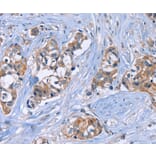 Immunohistochemistry - JAG1 Antibody from Signalway Antibody (37668) - Antibodies.com