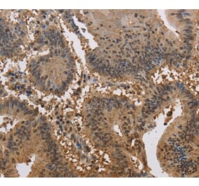 Immunohistochemistry - JAG2 Antibody from Signalway Antibody (37669) - Antibodies.com