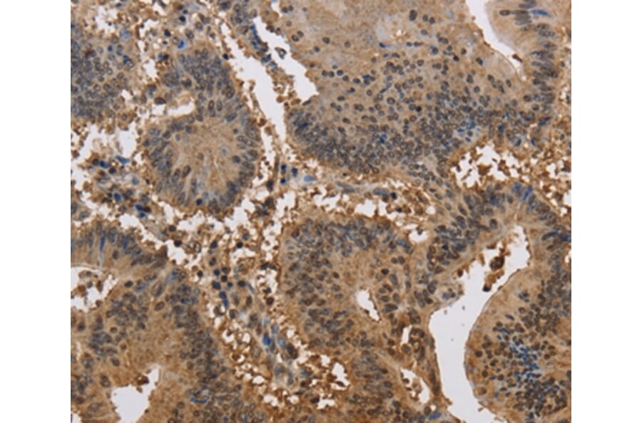 Immunohistochemistry - JAG2 Antibody from Signalway Antibody (37669) - Antibodies.com