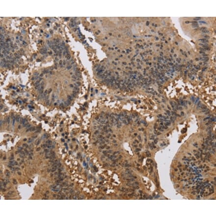 Immunohistochemistry - JAG2 Antibody from Signalway Antibody (37669) - Antibodies.com