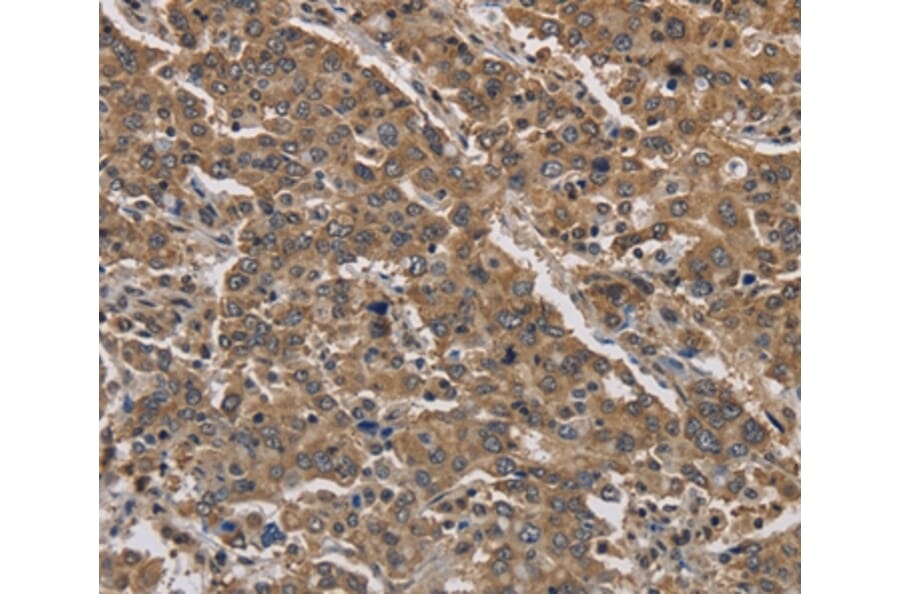 Immunohistochemistry - JAG2 Antibody from Signalway Antibody (37669) - Antibodies.com