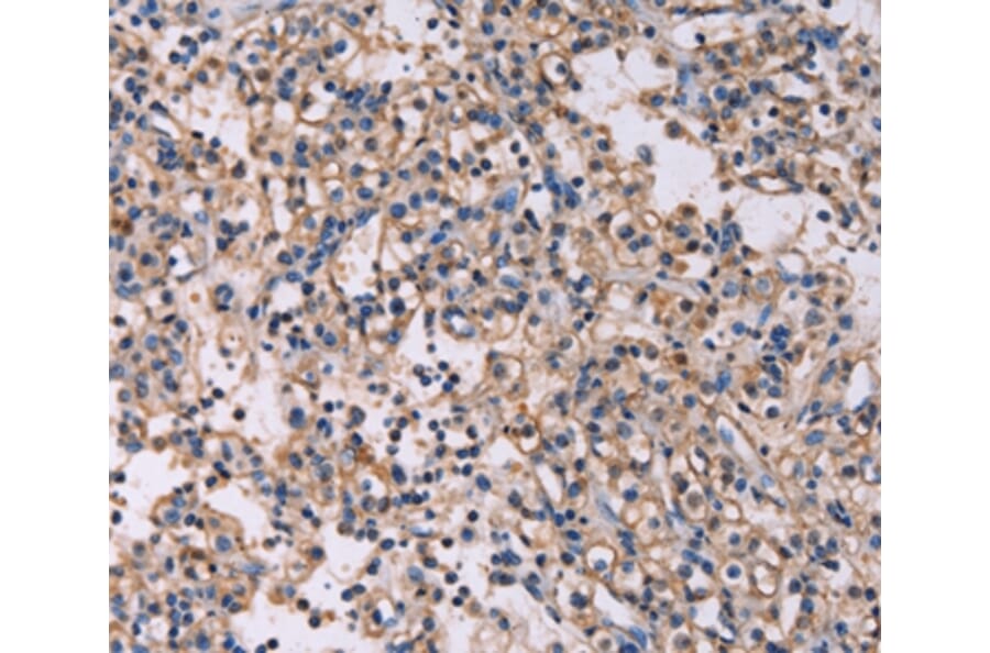 Immunohistochemistry - KSR1 Antibody from Signalway Antibody (37692) - Antibodies.com