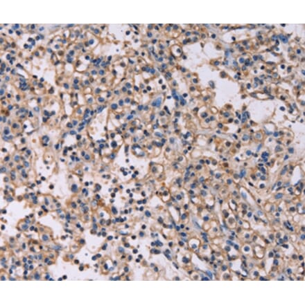 Immunohistochemistry - KSR1 Antibody from Signalway Antibody (37692) - Antibodies.com
