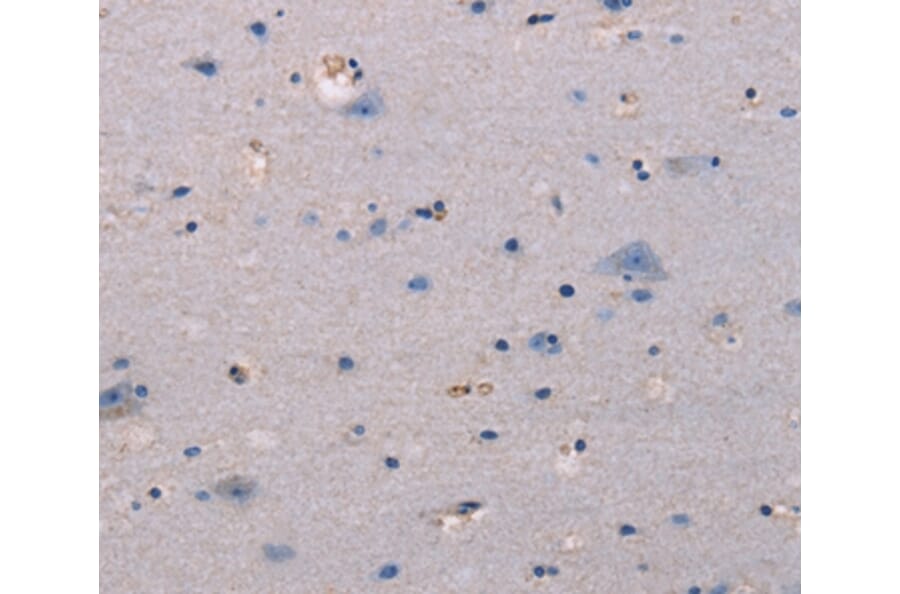 Immunohistochemistry - KSR1 Antibody from Signalway Antibody (37692) - Antibodies.com
