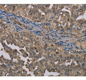 Immunohistochemistry - UBP1 Antibody from Signalway Antibody (37699) - Antibodies.com