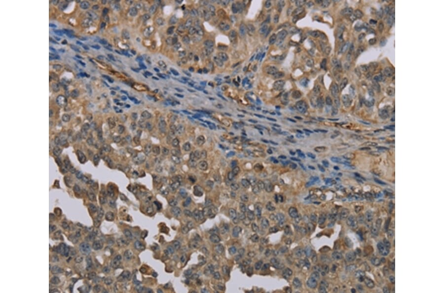 Immunohistochemistry - UBP1 Antibody from Signalway Antibody (37699) - Antibodies.com