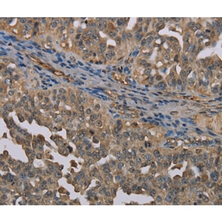 Immunohistochemistry - UBP1 Antibody from Signalway Antibody (37699) - Antibodies.com