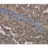 Immunohistochemistry - UBP1 Antibody from Signalway Antibody (37699) - Antibodies.com