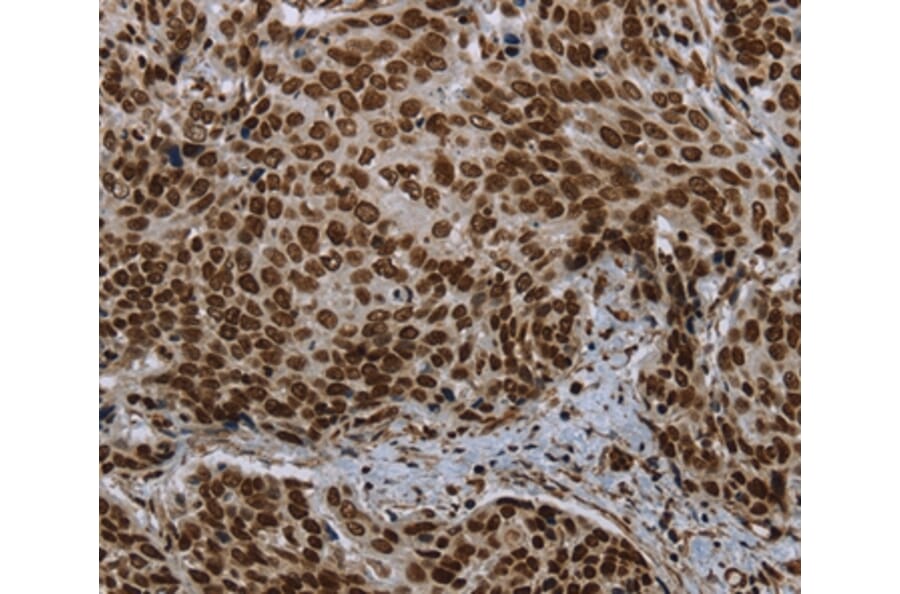 Immunohistochemistry - LEO1 Antibody from Signalway Antibody (37702) - Antibodies.com