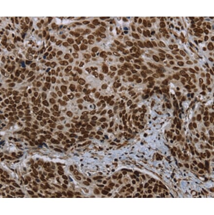 Immunohistochemistry - LEO1 Antibody from Signalway Antibody (37702) - Antibodies.com