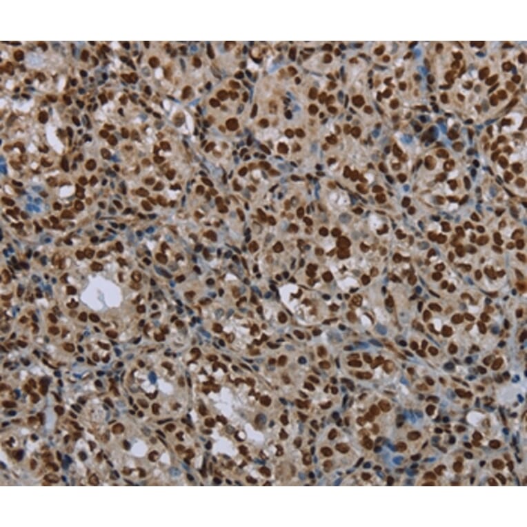 Immunohistochemistry - LEO1 Antibody from Signalway Antibody (37702) - Antibodies.com
