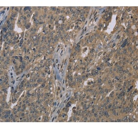 Immunohistochemistry - LGR4 Antibody from Signalway Antibody (37703) - Antibodies.com