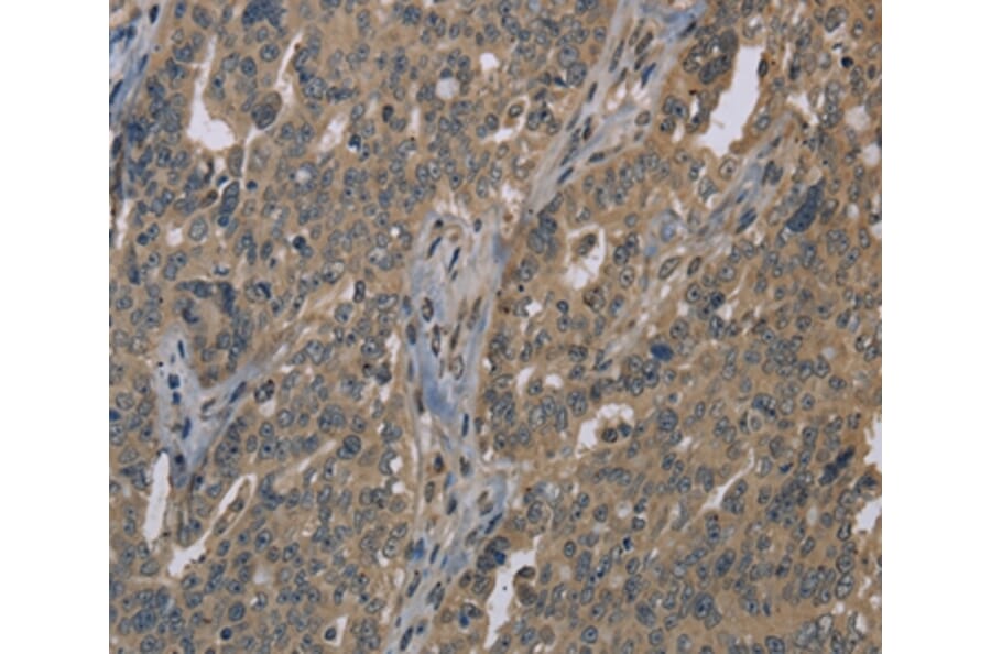 Immunohistochemistry - LGR4 Antibody from Signalway Antibody (37703) - Antibodies.com