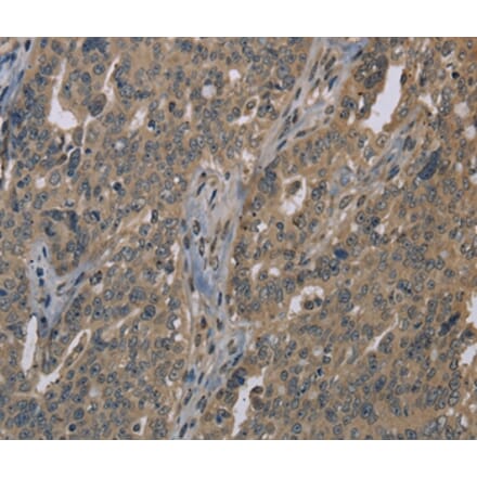 Immunohistochemistry - LGR4 Antibody from Signalway Antibody (37703) - Antibodies.com
