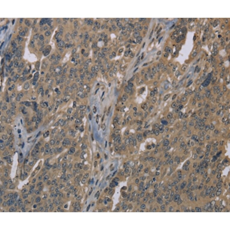 Immunohistochemistry - LGR4 Antibody from Signalway Antibody (37703) - Antibodies.com