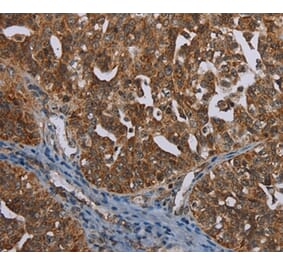 Immunohistochemistry - MIG7 Antibody from Signalway Antibody (37730) - Antibodies.com