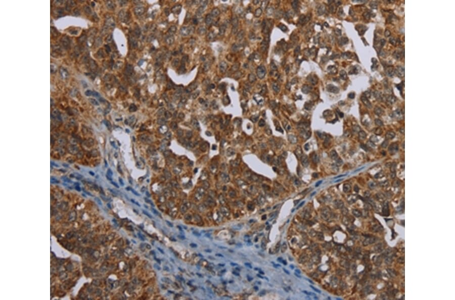 Immunohistochemistry - MIG7 Antibody from Signalway Antibody (37730) - Antibodies.com