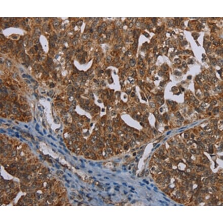 Immunohistochemistry - MIG7 Antibody from Signalway Antibody (37730) - Antibodies.com