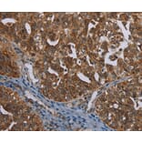 Immunohistochemistry - MIG7 Antibody from Signalway Antibody (37730) - Antibodies.com