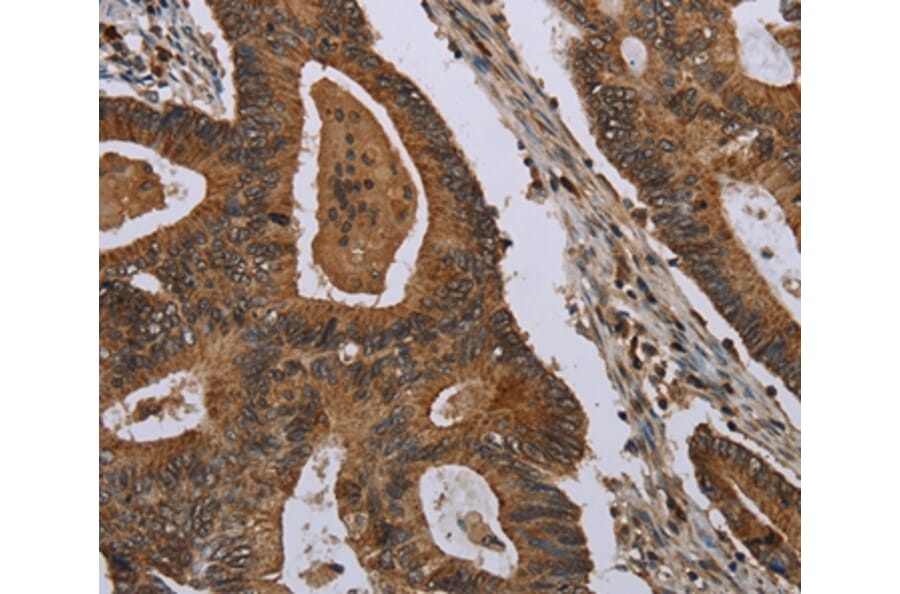 Immunohistochemistry - MIG7 Antibody from Signalway Antibody (37730) - Antibodies.com
