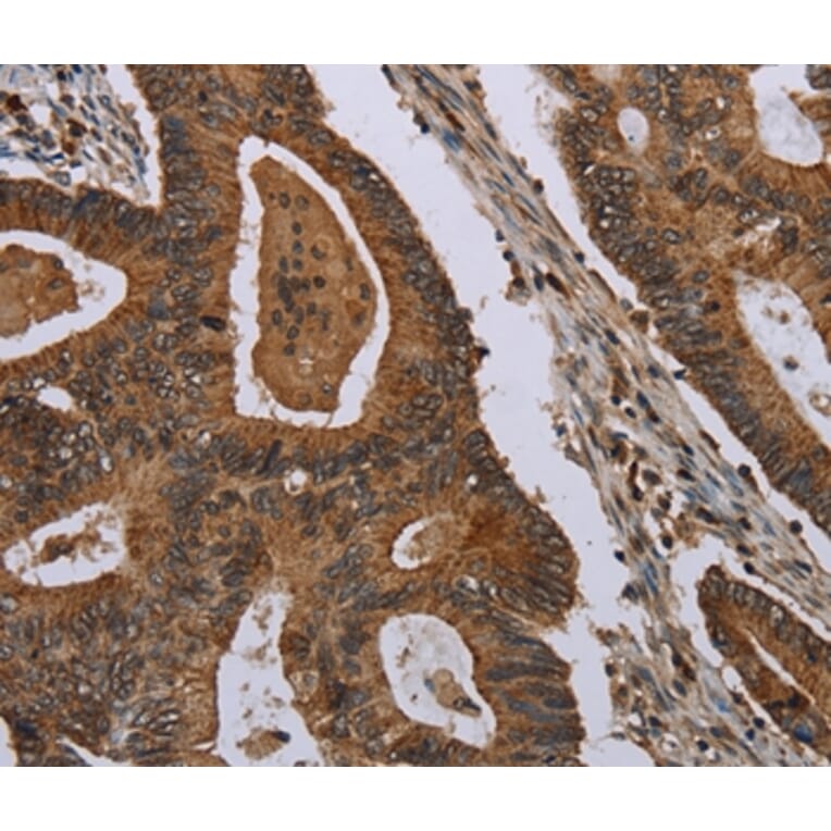 Immunohistochemistry - MIG7 Antibody from Signalway Antibody (37730) - Antibodies.com