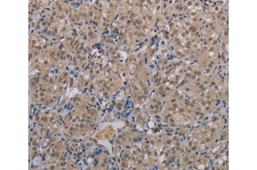 Immunohistochemistry - MGLL Antibody from Signalway Antibody (37738) - Antibodies.com