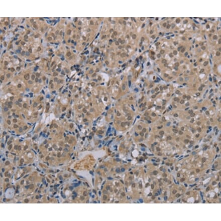 Immunohistochemistry - MGLL Antibody from Signalway Antibody (37738) - Antibodies.com