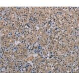 Immunohistochemistry - MGLL Antibody from Signalway Antibody (37738) - Antibodies.com