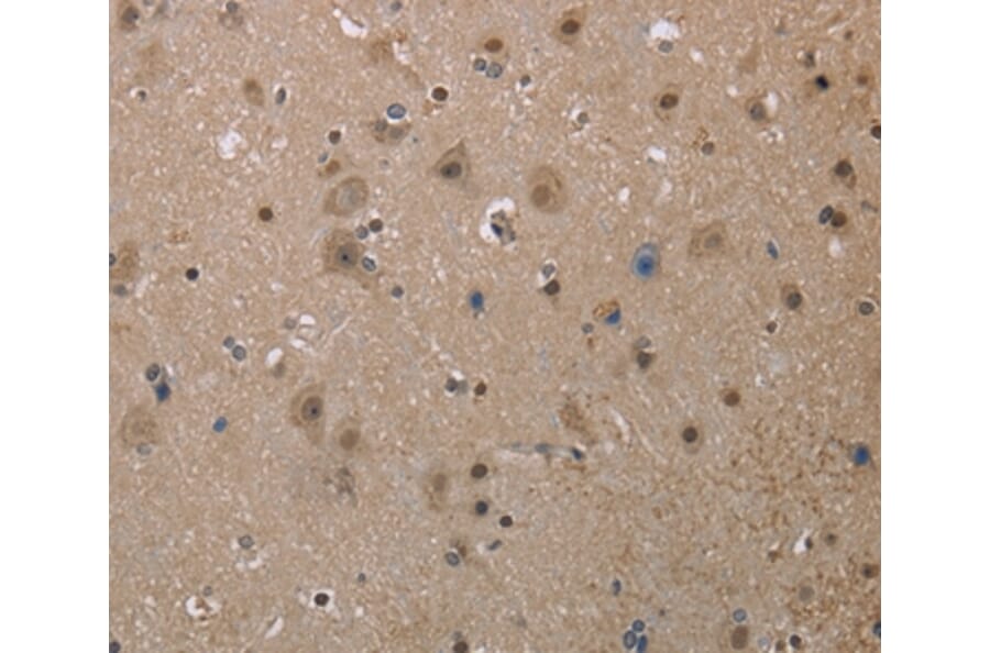 Immunohistochemistry - MGLL Antibody from Signalway Antibody (37738) - Antibodies.com