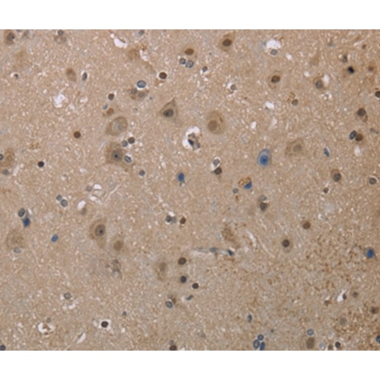 Immunohistochemistry - MGLL Antibody from Signalway Antibody (37738) - Antibodies.com