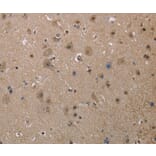 Immunohistochemistry - MGLL Antibody from Signalway Antibody (37738) - Antibodies.com