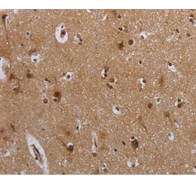 Immunohistochemistry - MTBP Antibody from Signalway Antibody (37741) - Antibodies.com