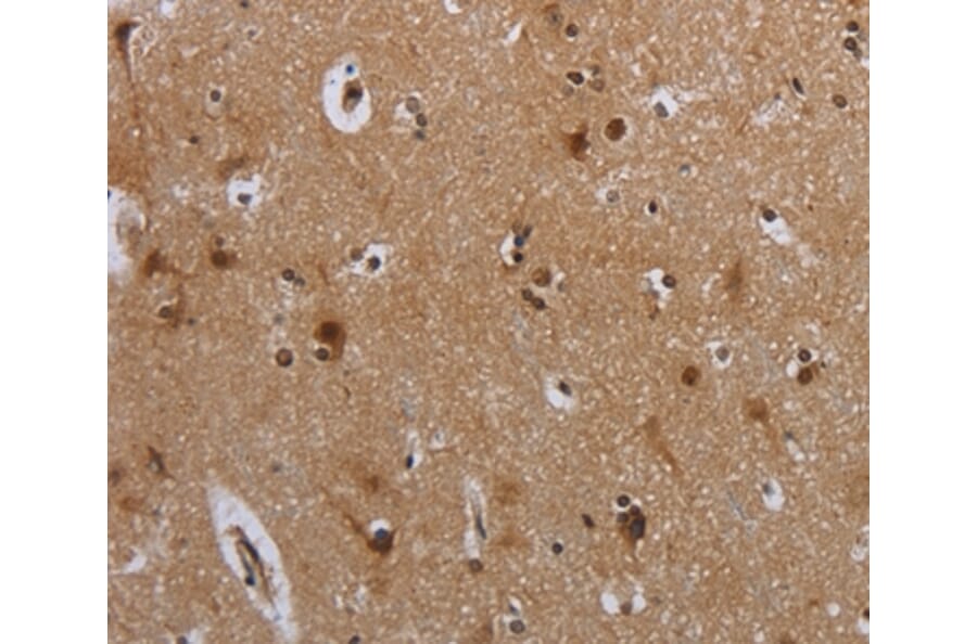 Immunohistochemistry - MTBP Antibody from Signalway Antibody (37741) - Antibodies.com