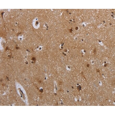 Immunohistochemistry - MTBP Antibody from Signalway Antibody (37741) - Antibodies.com