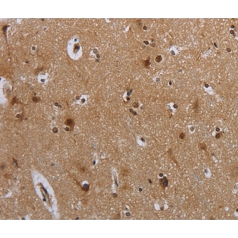 Immunohistochemistry - MTBP Antibody from Signalway Antibody (37741) - Antibodies.com