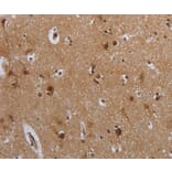 Immunohistochemistry - MTBP Antibody from Signalway Antibody (37741) - Antibodies.com