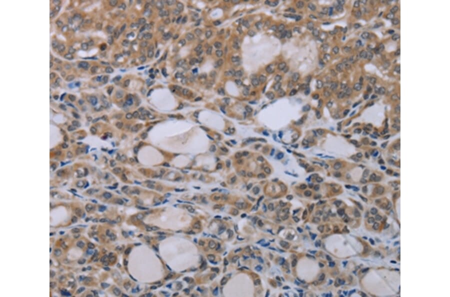 Immunohistochemistry - NAIP Antibody from Signalway Antibody (37749) - Antibodies.com