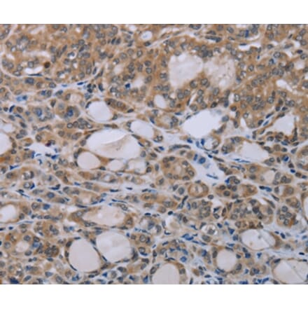 Immunohistochemistry - NAIP Antibody from Signalway Antibody (37749) - Antibodies.com