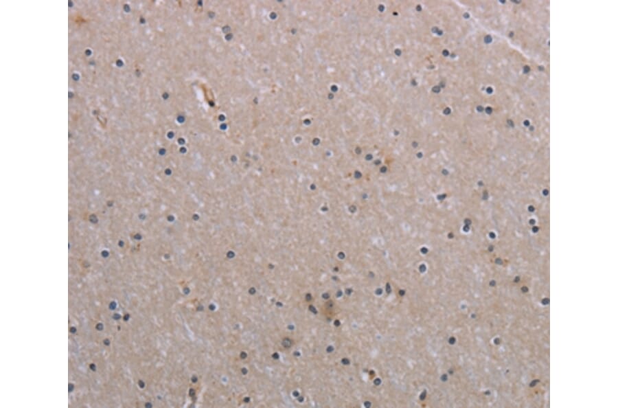 Immunohistochemistry - NAIP Antibody from Signalway Antibody (37749) - Antibodies.com