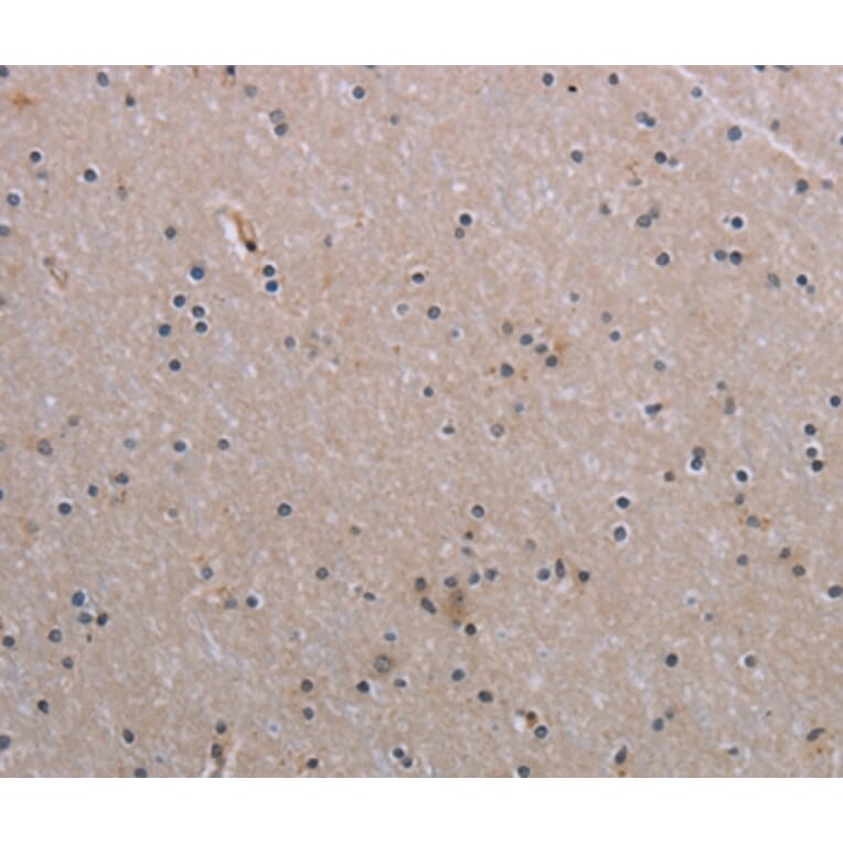 Immunohistochemistry - NAIP Antibody from Signalway Antibody (37749) - Antibodies.com